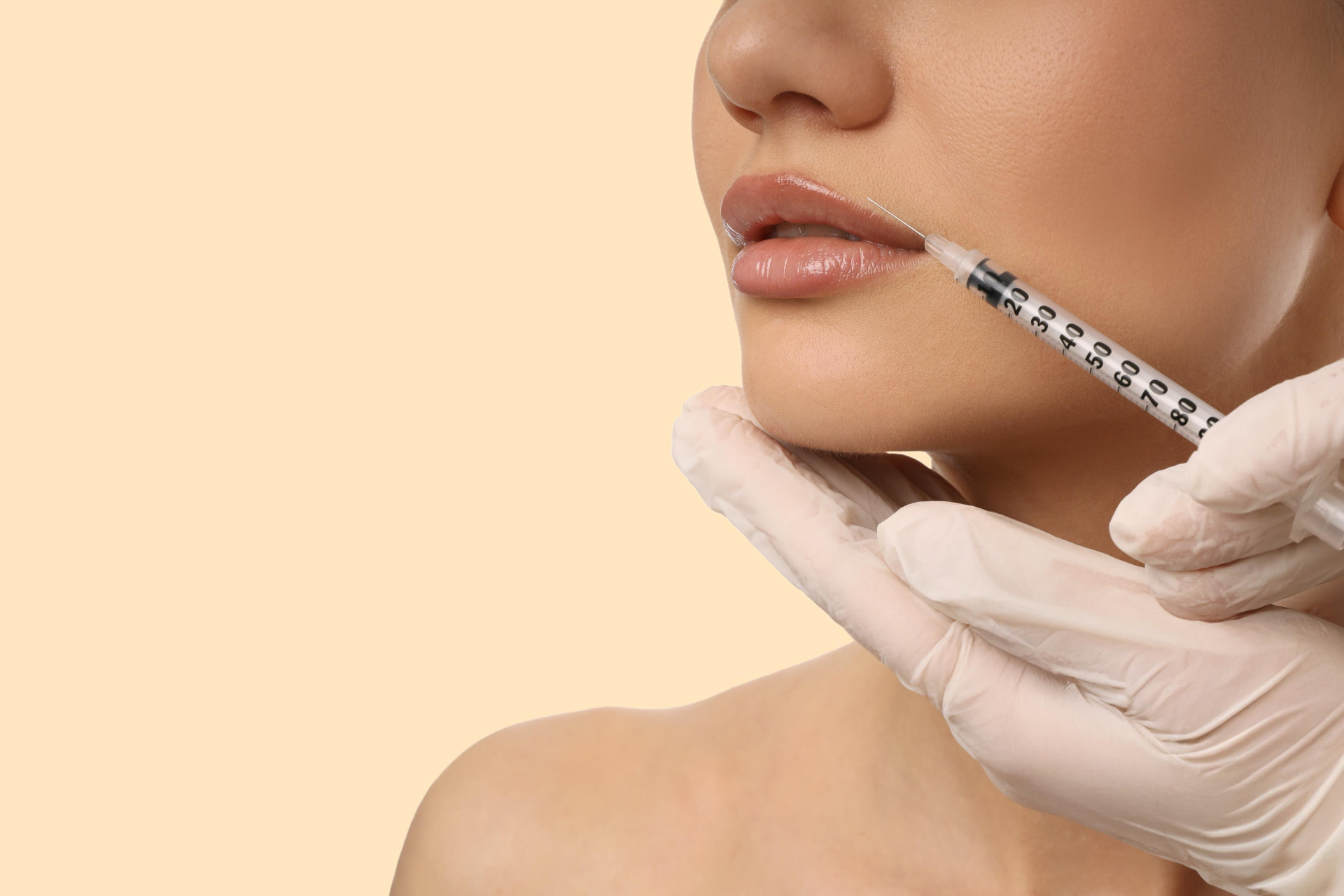 What Happens to Filler Over Time and When Dr. Cirillo-Hyland Recommends Dissolving It