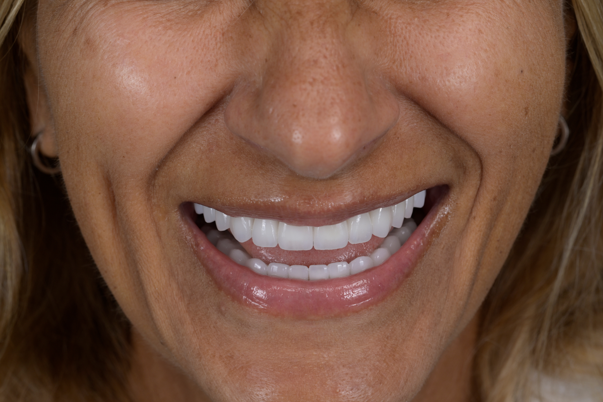 Turn Back the Clock — Starting With Your Smile