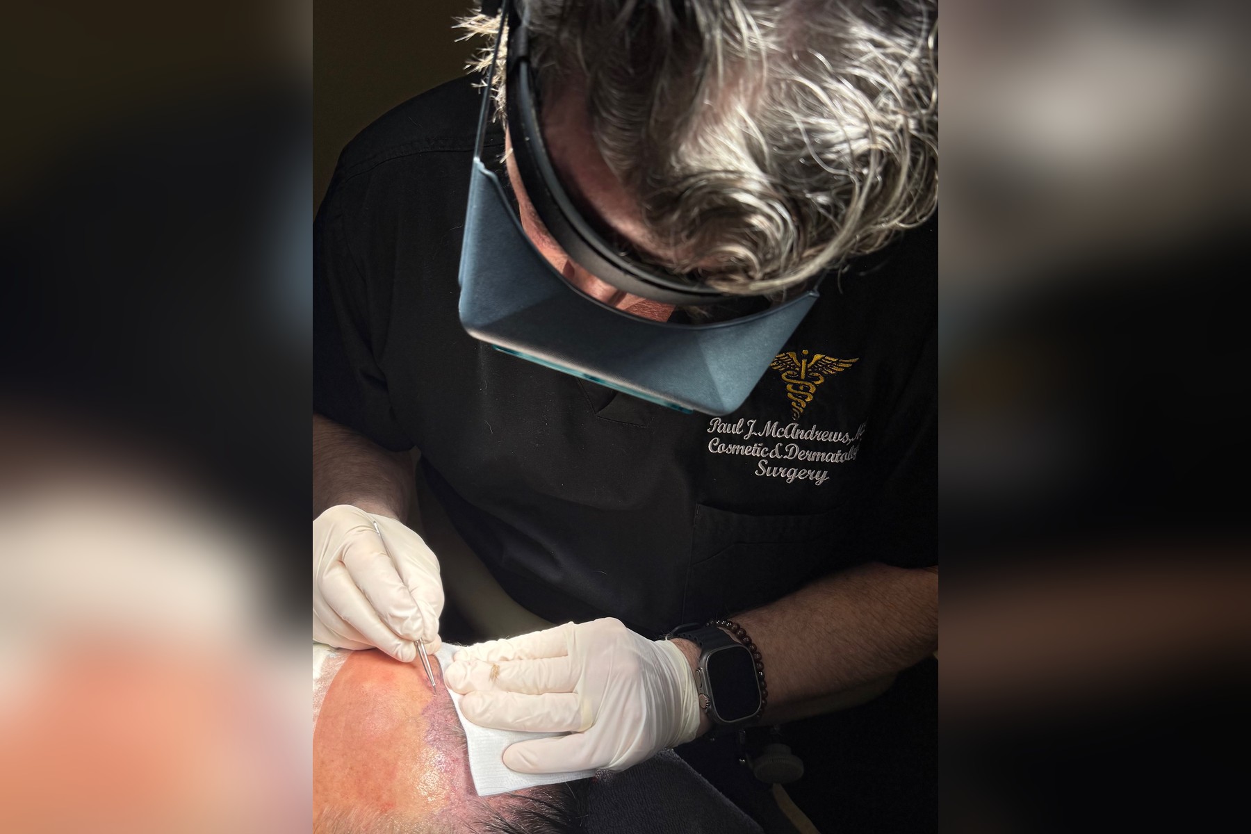 Dr. Paul J. McAndrews: The Los Angeles Hair Restoration Surgeon Behind the "McAndrews Method"