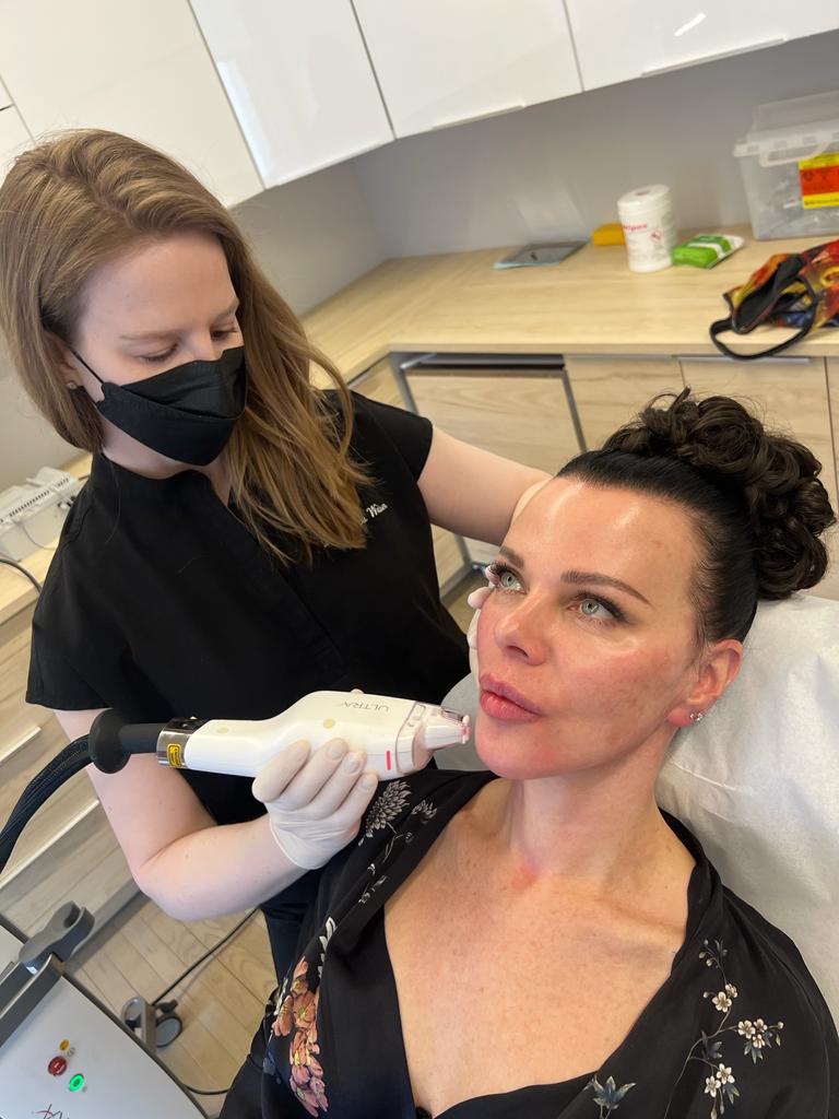 A patient receiving a laser skin rejuvenation treatment at Weiser Skin MD in SoHo, New York