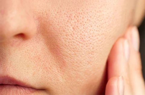 AI Can Now Measure Your Pores by Shape, Not Just Size