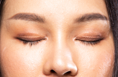 The Dangers of DIY Eye Tape and Filler Trends: A Surgeon's Perspective